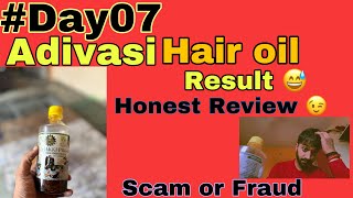 Adivasi Herbal Hair Oil 7 day Result  Original Adivasi Honest Review 😓 adivasihairoil [upl. by Alekal724]