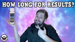 quotHow Long Before I See Resultsquot  Minoxidil Beards  BeardTalk  Ep 4 [upl. by Eislek]