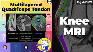 Fig 4B02 Anatomy of the Multilayered Quadriceps Tendon Part 2 [upl. by Iccir437]