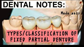 TYPES OF FIXED PARTIAL DENTURE II VARIOUS CLASSIFICATION II PROSTHODONTICS II imp [upl. by Hayouqes]