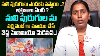 పర్మినెంట్ గా నులిపురుగులు పోవాలంటే  Symptoms And Causes Of Intestinal Worms  Best Homeo Medicine [upl. by Drofwarc]