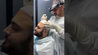 Precision in Action ✂️ Dr Habib During Hair Transplant Incision 🌟✨  Peshawar Pakistan 📍 [upl. by Aikenahs916]