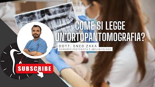 Come si legge una radiografia panoramica [upl. by Alburga]