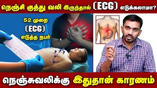 எல்லா நெஞ்சுவலியும் ஒன்னு கிடையாது  ECG எடுப்பவர்கள் கட்டாயம் பார்க்க வேண்டிய பதிவு  drsj aiimm [upl. by Aneerak598]