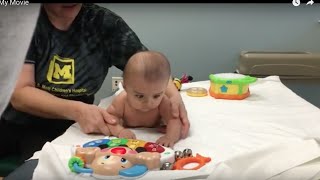 BABY GETS PHYSICAL THERAPY FOR TORTICOLLIS [upl. by Gardener]