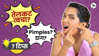 Acne Spot Removal  Oily Skin Moisturizer  Pimples Treatment at Home  Acne Scars Urmila Nimbalkar [upl. by Joshua58]