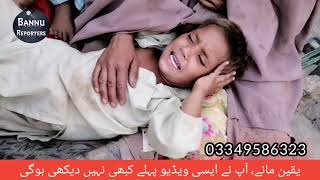 quotImperforate Anusquot Patient in Bannu [upl. by Normac]