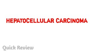 Hepatocellular carcinoma  Pathology  Easy explaination  MBBS [upl. by Nortyad]