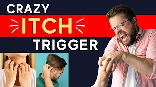 Got Itchy Skin Without Rash The SHOCKING Neuropathic Itch Trigger Explained  Dr Shawn Kwatra [upl. by Anaihsat]