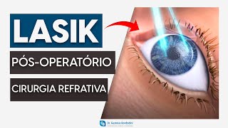 Cirurgia refrativa LASIK recuperação no pósoperatório  Dr Gustavo Bonfadini [upl. by Anastasie442]