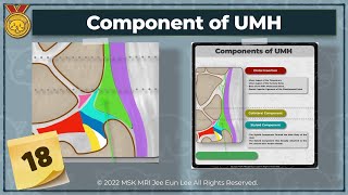 KOR Anatomy18 Component of ulnomeniscal homologue TFCC wrist MRI [upl. by Romeo58]