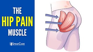 The Hip Pain Muscle How to Release It for INSTANT RELIEF [upl. by Bickart]