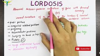 Lordosis  Medical Symptomatology [upl. by Moraj]