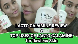 LACTO CALAMINE LOTION REVIEW AND USES [upl. by Airtina]