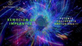 REMOCION DE IMPLANTES 🔴 Frecuencia Arcturiana 👽 Vivi Pedraglio [upl. by Kobylak176]