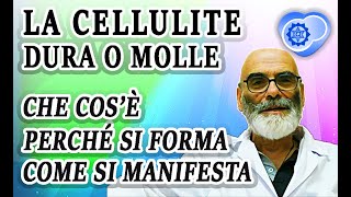 La Cellulite  Che Cosè Come si Forma Come Riconoscerla [upl. by Barfuss116]