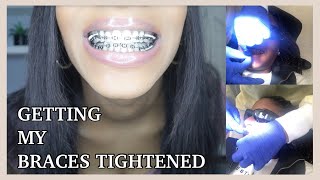 Getting My Braces TIGHTENED For The First Time  How To Prepare Yourself and What To Expect [upl. by Azne]