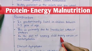 Protein  Energy Malnutrition  Kwashiorkor  Marasmus  Biochemistry [upl. by Rollo]