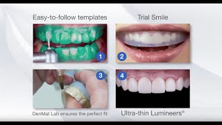 The Additive Reductive Template ART StepByStep Process  DenMat Dental Lab [upl. by Edmond]