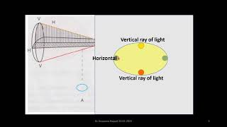 Sturms Conoid made simple for Medical Undergraduate students by Dr Anupama Bappal [upl. by Gilus]