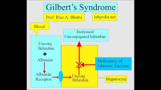 Gilberts syndrome by labpedianet Prof Riaz A Bhutta Urdu Hindi [upl. by Erund]