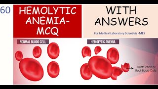 Hemolytic Anemia Review  MCQs With Answers [upl. by Gare]