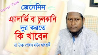 এলার্জি চুলকানি দূর করার সহজ উপায়  Allergy Treatment  Bangla Health Tips [upl. by Eemiaj320]