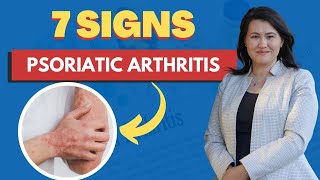 Psoriatic Arthritis 7 Signs and Symptoms  A Rheumatologist Review [upl. by Arihsaj]