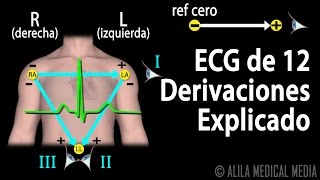 ECG de 12 Derivaciones Explicado Animación Alila Medical Media Español [upl. by Khichabia]