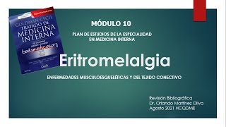 Eritromelalgia ETM [upl. by Hertha]