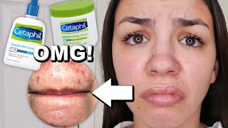 I Used Cetaphil Skincare For One Week [upl. by Annoled]