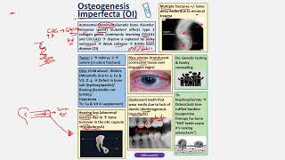 Osteogenesis Imperfecta CBL [upl. by Alien]