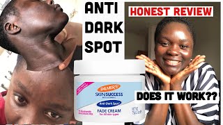 Palmer’s Skin Success Fade Cream Honest Review Dark Spot and Eventone Face Cream [upl. by Pawsner]