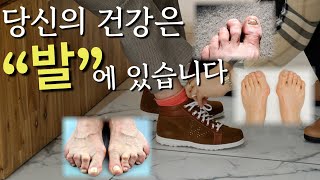 이 신발은 꼭 신어 보셔야 합니다  전신 건강은 발에 달려 있다  10년 고객이 될 수 밖에 없는 건강 기능성 신발의 놀라운 효과 [upl. by Chak]