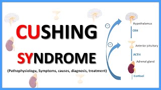 Cushing SyndromeCauses Clinical features Diagnosis Treatment Pathophysiology [upl. by Aronson]