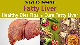 Ways To Reverse A Fatty Liver Healthy Diet Tips For Cure Fatty Liver [upl. by Eem]