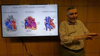 Pathophysiology of Cyanotic Congenital Heart Disease  Hatem Hosny [upl. by Clari]