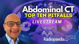 Top ten pitfalls in abdominal CT with Vikas Shah [upl. by Eylrahc]