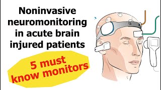 5 Noninvasive neuromonitoring in Neuro ICU That you must know [upl. by Essilevi]