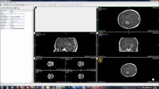 Dr Eye  Open a MetaImage Raw file using VolView [upl. by Stewardson]