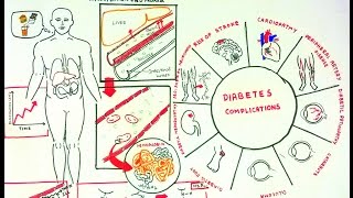 Advanced Glycosylation End Products and Diabeteic complications [upl. by Wertz609]