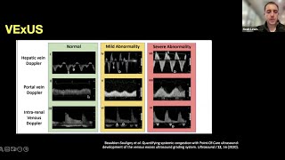 Hocus Pocus Using POCUS for Volume amp Hemodynamics Assessment and Quick Peculiar Diagnoses [upl. by Ilenna]