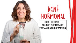 ACNÉ HORMONAL  Tratamiento cosmético y natural [upl. by Kelci]