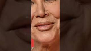 Kris Jenner has a “cyst and a small tumourquot krisjenner [upl. by Revlis]