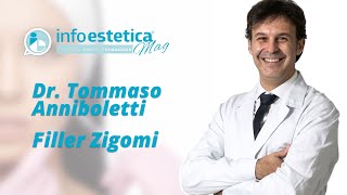 Dimostrazione Filler zigomi Roma  DrTommaso Anniboletti [upl. by Elsey]