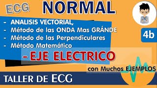 MÉTODOS para calcular el EJE ELECTRICO CARDIACO en el ELECTROCARDIOGRAMA ANALISIS VECTORIAL casos [upl. by Larrie816]