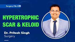 Topic  HYPERTROPHIC SCAR amp KELOID I Dr Pritesh SIngh  Surgery [upl. by Aenal]