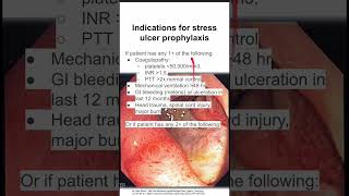 Indications for stress ulcer prophylaxis [upl. by Danas295]