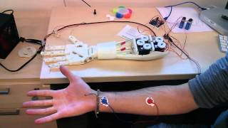 Roujin Project  InMoov Arm and EMG 1 [upl. by Airotal]