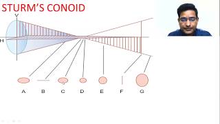 Sturms conoid amp Its clinical application by Dr Pradeep DubeyImagination amp Animation [upl. by Maccarone235]